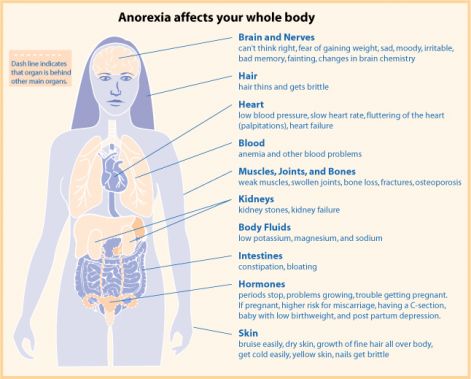 anorexiafaqdia06.jpg